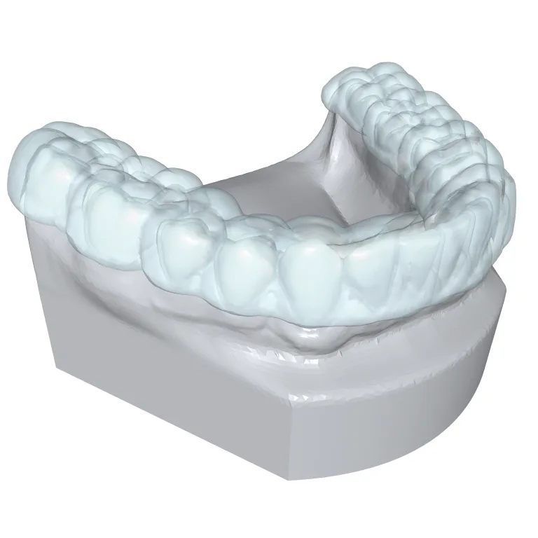 Clear aligner seated on a printed dental model