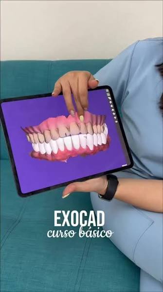 Full-arch ExoCAD design reviewed on a tablet before delivery
